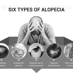 Fast Hair Growth Spray for Men - Emporium Shop