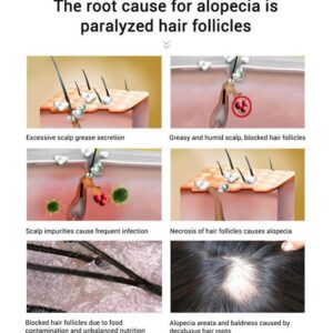 Fast Hair Growth Spray for Men - Emporium Shop