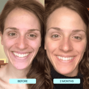 SkynPure™ - Pure Collagen Films - Emporium Shop