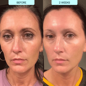 SkynPure™ - Pure Collagen Films - Emporium Shop