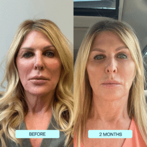 SkynPure™ - Pure Collagen Films - Emporium Shop