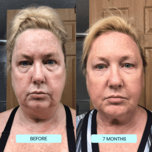 SkynPure™ - Pure Collagen Films - Emporium Shop